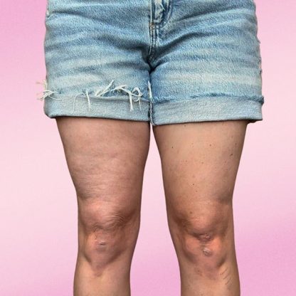 10x InvisiLift Plastry Ujędrniające Skórę